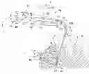 Fig. 01 - MEDICAL IRRIGATION DEVICE