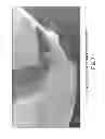 Fig. 08 - MEDICAL IRRIGATION DEVICE
