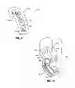 Fig. 49 - Impressionless dental modeling systems and methods