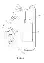 Fig. 04 - DEVICE OF COMPUTERIZED DENTAL MEASUREMENT AND MEASURING METHOD USABLE WITH SAID DEVICE