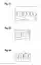 Fig. 04 - TOOTH REPLACEMENT