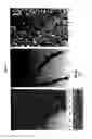 Fig. 04 - METHOD, COMPOSITION AND KIT OF VISUALISATION AND CHARACTERIZATION OF THE NERVOUS SYSTEM BY COMBINING THE STAINING FOR METAL IMPREGNATION AND IMMUNOHISTOCHEMISTRY