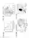 Fig. 09 - Particle measuring apparatus