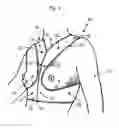 Fig. 02 - Brassière
