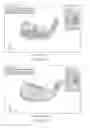 Fig. 10 - Set of golf clubs