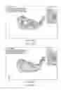 Fig. 20 - Set of golf clubs