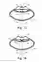Fig. 09 - System and method for a game racquet including an actuator