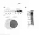 Fig. 02 - PROSTATE CANCER MARKERS AND USES THEREOF