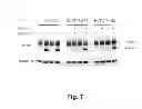 Fig. 13 - METHODS FOR TREATING CANCER RESISTANT TO ERBB THERAPEUTICS
