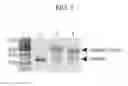 Fig. 08 - Protein-immobilizing solid phase, polynucleotide-immobilizing solid phase, and nucleic acid recovery method
