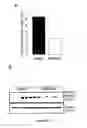Fig. 02 - Compositions and methods for the treatment of cardiac surgery-associated acute kidney injury with annexin A1 peptide
