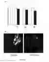 Fig. 07 - Compositions and methods for the treatment of cardiac surgery-associated acute kidney injury with annexin A1 peptide