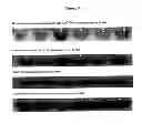 Fig. 10 - Method of reducing cell death by administering a paracrine factor derived from a mesenchymal stem cell