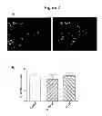 Fig. 03 - Oligodendrocyte Differentiation