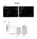 Fig. 04 - Oligodendrocyte Differentiation
