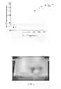 Fig. 07 - METHOD OF PREVENTING DEVELOPMENT OF PSORIATIC LESIONS