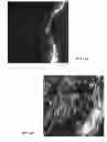 Fig. 08 - METHOD OF PREVENTING DEVELOPMENT OF PSORIATIC LESIONS