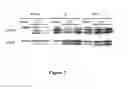 Fig. 03 - Bisphosphonate compositions and methods for treating and\or reducing cardiac dysfunction