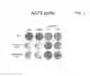 Fig. 20 - METHODS AND COMPOSITIONS FOR PREDICTING RESISTANCE TO ANTICANCER TREATMENT