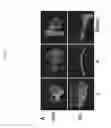 Fig. 07 - Therapeutic methods and compositions involving allosteric kinase inhibition