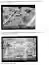Fig. 08 - Pharmaceutical preparation containing oxycodone and naloxone