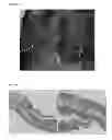 Fig. 03 - Methods and compositions for locally increasing body fat