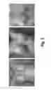 Fig. 03 - Pharmaceutical composition containing pirfenidone in sustained-release tablet form