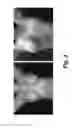 Fig. 04 - Pharmaceutical composition containing pirfenidone in sustained-release tablet form