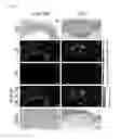 Fig. 03 - Prophylactic and/or therapeutic agent for cardiovascular complications of diabetes