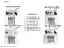 Fig. 04 - Prion free nanoparticle compositions and methods of making thereof