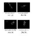 Fig. 03 - Antisense design