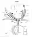 Fig. 49 - Heart help device, system and method