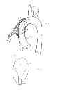 Fig. 02 - Implantable device utilizing arterial deformation