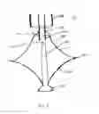 Fig. 03 - Ventricular volume reduction