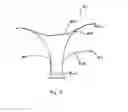 Fig. 08 - Ventricular volume reduction