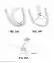 Fig. 22 - Ventricular volume reduction