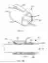 Fig. 14 - OPERATIVE ELEMENT SUPPORT STRUCTURE WITH CLOSED TUBULAR BASE