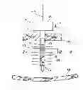 Fig. 01 - Trocar sleeve