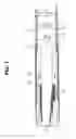 Fig. 07 - Endoscope with electrical conductive portion
