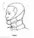 Fig. 04 - Dynamically reactive spinal support system