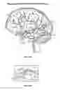 Fig. 04 - Detecting and treating nervous system disorders