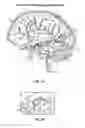 Fig. 06 - Detecting and treating nervous system disorders
