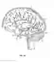 Fig. 07 - Detecting and treating nervous system disorders