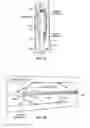 Fig. 09 - Detecting and treating nervous system disorders