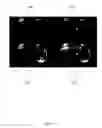 Fig. 04 - Magnetic resonance imaging (MRI) based quantitative liver perfusion analysis