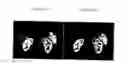 Fig. 11 - Magnetic resonance imaging (MRI) with self-navigation and self-registration