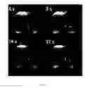 Fig. 14 - Magnetic resonance imaging (MRI) with self-navigation and self-registration