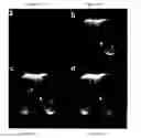 Fig. 15 - Magnetic resonance imaging (MRI) with self-navigation and self-registration
