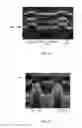 Fig. 07 - ULTRASONIC PROBE, BIOINFORMATION MEASUREMENT DEVICE, AND BIOINFORMATION MEASUREMENT METHOD