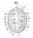 Fig. 02 - IMPLANTABLE PRESSURE MEASURING DEVICE